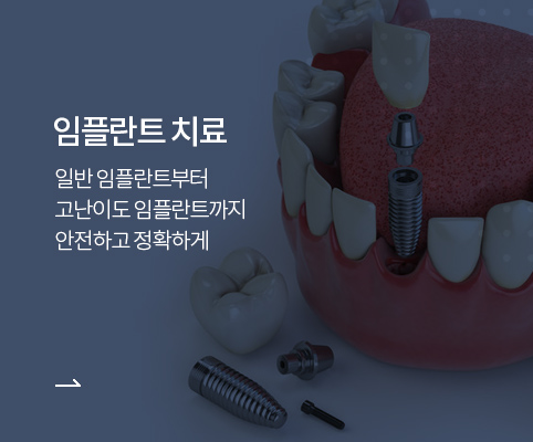 임플란트 치료